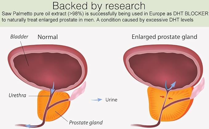 DHT Focus Pure Saw Palmetto Oil Organic Natural with Beta Sitosterol, Biotin Support Helps Prostate Health Sleep Better Reduce Frequent Urination DHT Blocker Stop Hair Loss (30-Day Supply)